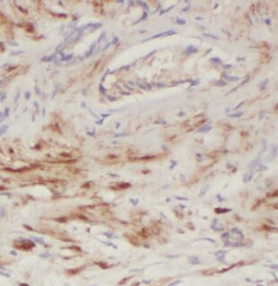 ECHS1 Antibody (1H0)