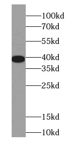 EEF1D Antibody (6D9)