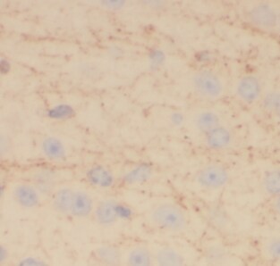 EIF3D Antibody (2D11)