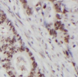RRP4 Antibody (6E9)