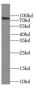 FAF1 Antibody (9H10)