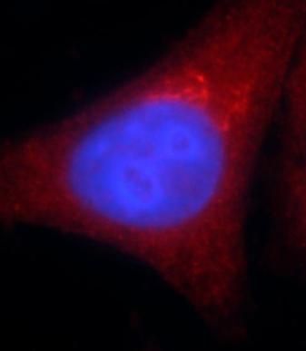 alcohol dehydrogenase 5 Antibody (3E7)