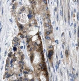 alcohol dehydrogenase 5 Antibody (3E7)