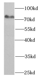 HADHA Antibody (6A0)