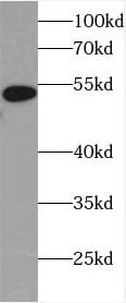 Heparanase/HPSE Antibody (0C0)