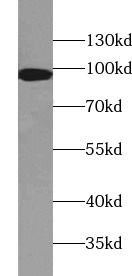 IFT88 Antibody (2B2)