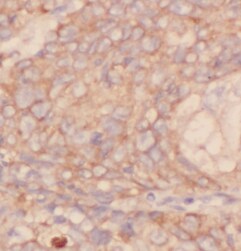 IVD Antibody (5F5)