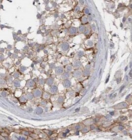 KIFAP3 Antibody (0H5)