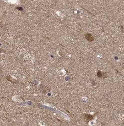 Monoamine Oxidase B Antibody (8E0)