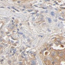 Melanophilin Antibody (8B2)