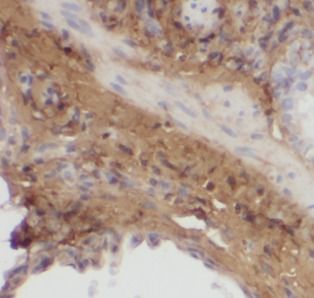 MGP Antibody (8C3)