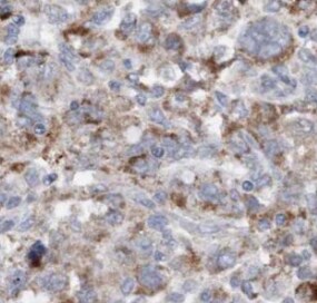 MMS19 like protein Antibody (6H1)