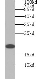 Myosin Light Chain 2 Antibody (1F7)
