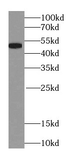 NAPRT1 Antibody (0C6)