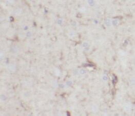 NCALD Antibody (9G5)