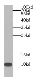 NDUFA4L2 Antibody (0B11)