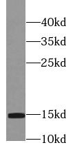 Profilin 2 Antibody (5D4)
