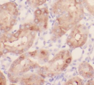 PLAP Antibody (8F0)