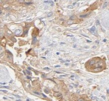 PLOD3 Antibody (2B1)