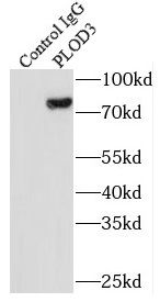 PLOD3 Antibody (2B1)