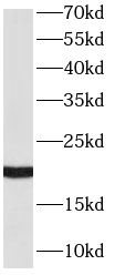 RAC2 Antibody (8F0)