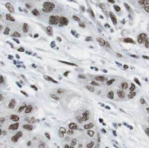 RBBP9 Antibody (7E10)