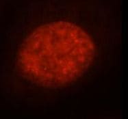 RBM15 Antibody (6B1)