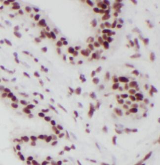 RBM15 Antibody (6B1)