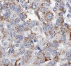 RBM4 Antibody (6F6)