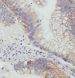 ST6 Sialyltransferase 6/ST6GALNAC6 Antibody (1F4)