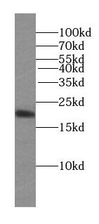 STMN3 Antibody (6D5)