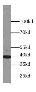 SLP-2 Antibody (5D10)