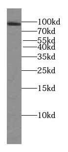 TFIP11 Antibody (3H5)