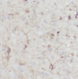 TMEM106B Antibody (6H1)