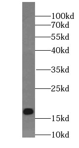 TMEM70 Antibody (4F2)
