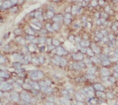 transgelin 2 Antibody (7D0)