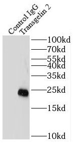 transgelin 2 Antibody (7D0)