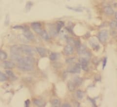 TRUSS Antibody (1C0)