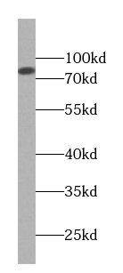 TRUSS Antibody (1C0)
