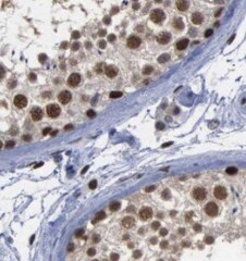 USP13 Antibody (9E6)