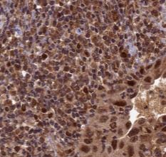 WTAP Antibody (9D4)