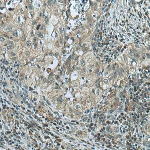 Glucose 6 phosphate isomerase Antibody (4F11)
