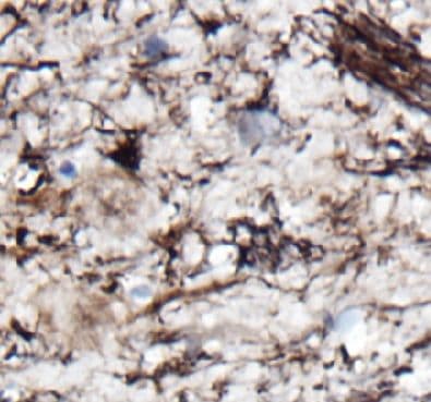 NDRG2 Antibody (4H3)