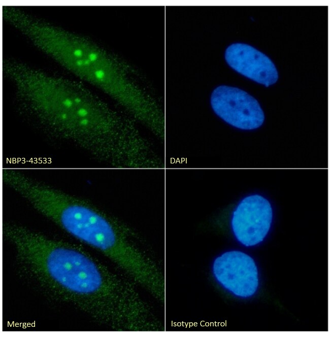 RRM2 Antibody (SAIC-30E-7) - Chimeric - BSA Free RRM2 Antibody (SAIC-30E-7) - Chimeric - BSA Free