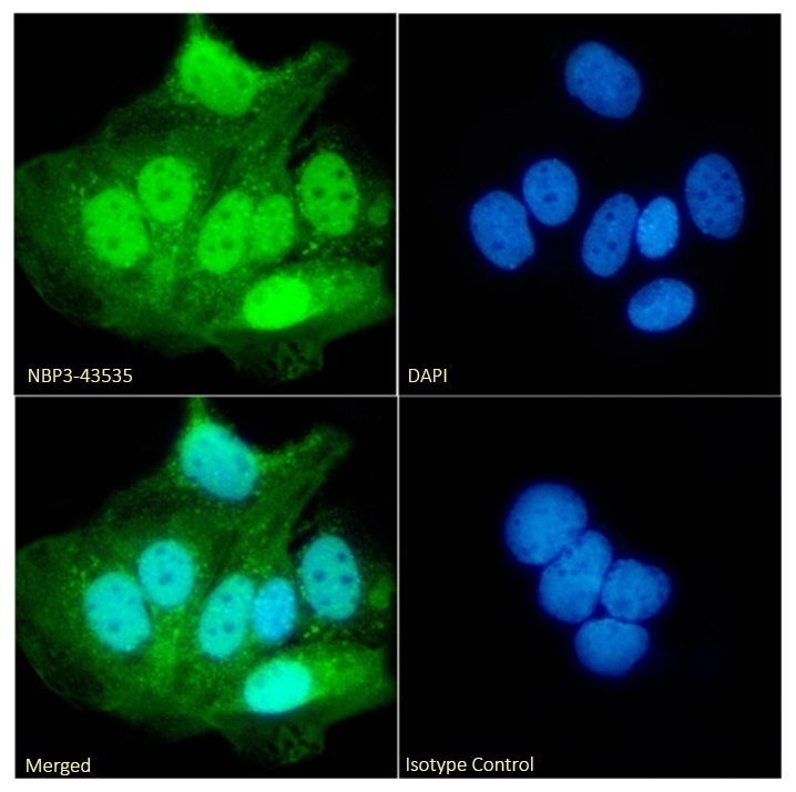 UbcH10/UBE2C Antibody (SAIC-41C-6) - Chimeric - BSA Free UbcH10/UBE2C Antibody (SAIC-41C-6) - Chimeric - BSA Free