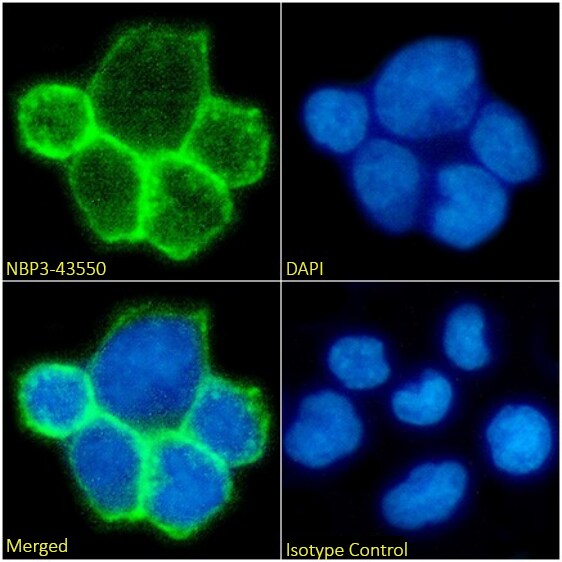 TCR alpha/beta Antibody (BMA031) - Chimeric - BSA Free TCR alpha/beta Antibody (BMA031) - Chimeric - BSA Free