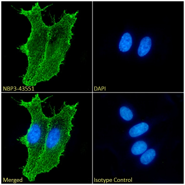 Ganglioside GD2 Antibody (14G2a) - Chimeric - BSA Free Ganglioside GD2 Antibody (14G2a) - Chimeric - BSA Free