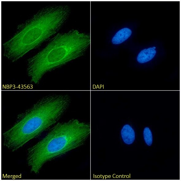 Actin (Muscle Specific) Antibody (3G8C7A6) - Chimeric - BSA Free Actin (Muscle Specific) Antibody (3G8C7A6) - Chimeric - BSA Free