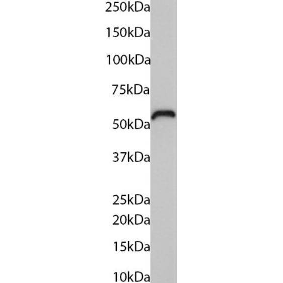 Cytokeratin 5/6 Antibody (AbM58019-7H4) - Chimeric - BSA Free Cytokeratin 5/6 Antibody (AbM58019-7H4) - Chimeric - BSA Free