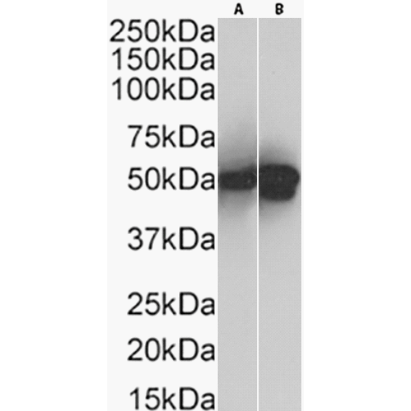 Cytokeratin 17 Antibody (4D2) - Chimeric - BSA Free Cytokeratin 17 Antibody (4D2) - Chimeric - BSA Free